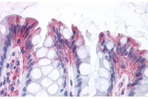 GPR82 anticorps  (Cytoplasmic Domain)