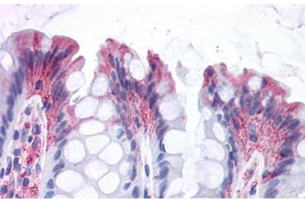 GPR82 Antikörper  (Cytoplasmic Domain)