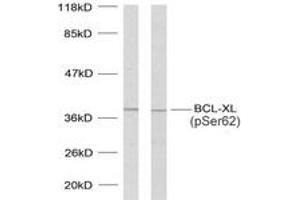 Western blot analysis of extracts from 293 cells treated with UV and MDA-MB-435 cells treated with UV, using BCL-XL (Phospho-Ser62) Antibody. (BCL2L1 antibody  (pSer62))