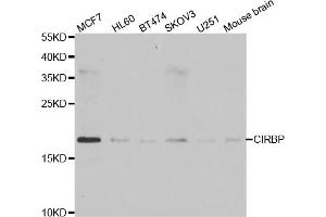 Western blot analysis of extracts of various cell lines, using CIRBP antibody (ABIN5973938) at 1/1000 dilution. (CIRBP antibody)