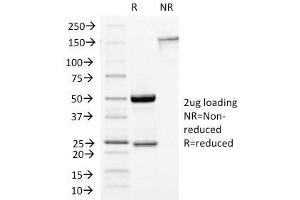 SDS-PAGE Analysis Purified Growth Hormone Mouse Monoclonal Antibody (GH/1450). (Growth Hormone 1 antibody  (AA 58-187))