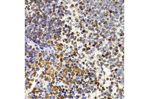 Immunohistochemistry of paraffin-embedded rat spleen using HIRIP3 antibody at dilution of 1:100 (x400 lens). (HIRIP3 antibody)