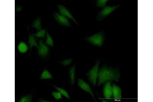 Immunofluorescence of monoclonal antibody to UBE2G1 on HeLa cell. (UBE2G1 antibody  (AA 1-170))