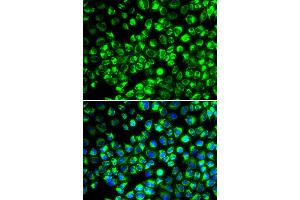 Immunofluorescence analysis of HeLa cell using ATP6AP2 antibody.