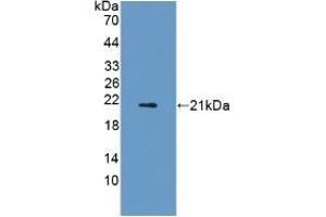 Detection of Recombinant ADIPOR2, Rat using Polyclonal Antibody to Adiponectin Receptor 2 (ADIPOR2) (Adiponectin Receptor 2 antibody  (AA 1-147))