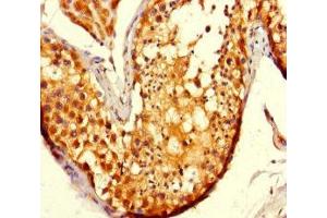 Immunohistochemistry of paraffin-embedded human testis tissue using ABIN7177995 at dilution of 1:100 (ADCK2 antibody  (AA 200-609))