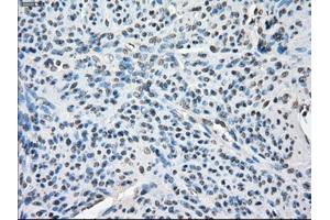 Immunohistochemical staining of paraffin-embedded colon tissue using anti-BUB1Bmouse monoclonal antibody. (BUB1B antibody)