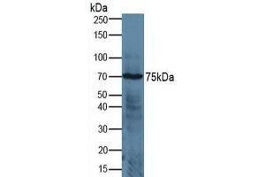 Detection of ADAM17 in Human Jurkat Cells using Polyclonal Antibody to A Disintegrin And Metalloprotease 17 (ADAM17) (ADAM17 antibody  (AA 226-473))