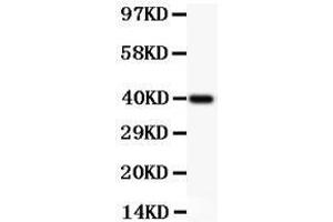 Western Blotting (WB) image for anti-Nuclear Factor of kappa Light Polypeptide Gene Enhancer in B-Cells 2 (NFKB2) (AA 1-340) antibody (ABIN3043293)