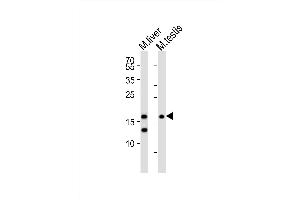 Western blot analysis of lysates from mouse liver, mouse testis tissue (from left to right), using (Mouse) Dppa3 Antibody (C-term) (ABIN6242289 and ABIN6577718).