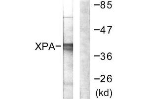 Western blot analysis of extracts from COLO205 cells, using XPA antibody. (XPA antibody  (C-Term))