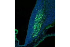 (ABIN6244147 and ABIN6577773) staining SKOR2 in mouse cerebellum at embryonic stage 12. (SKOR2 antibody  (C-Term))
