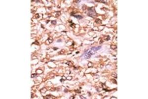 Image no. 2 for anti-Tumor Protein P53 (TP53) (pThr18) antibody (ABIN358195) (p53 antibody  (pThr18))