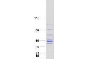 Western Blotting (WB) image for NADH Dehydrogenase (Ubiquinone) 1 alpha Subcomplex, Assembly Factor 1 (NDUFAF1) protein (Myc-DYKDDDDK Tag) (ABIN2727012)