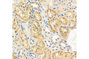Immunohistochemistry (Paraffin-embedded Sections) (IHC (p)) image for anti-Retinol Binding Protein 4, Plasma (RBP4) antibody (ABIN7075409)