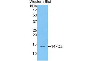 Western blot analysis of the recombinant protein. (Resistin antibody  (AA 21-114))
