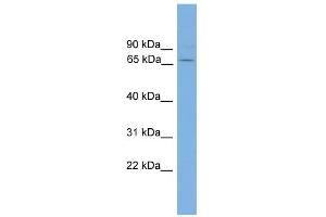 WB Suggested Anti-GAD1 Antibody Titration: 0. (GAD antibody  (N-Term))