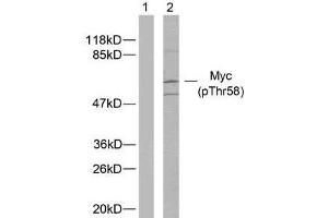 Western blot analysis of extracts from ovary cancer cells using Myc (phospho-Thr58) antibody (E011034). (c-MYC antibody  (pThr58))