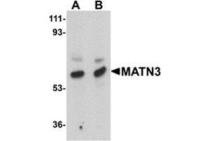 Western Blotting (WB) image for anti-Matrilin 3 (MATN3) (Middle Region) antibody (ABIN1030996) (Matrilin 3 antibody  (Middle Region))