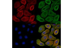 ABIN7093304 and ABIN7097323 staining H2O2 treated Hela cells by IF/ICC. (ERK1 antibody  (pTyr205, pTyr222))