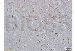 Formalin-fixed and paraffin embedded rat brain tissue labeled with Rabbit Anti-EpCAM/CD326 Polyclonal Antibody (ABIN670611), Unconjugated at 1:200 followed by conjugation to the secondary antibody and DAB staining. (EpCAM antibody  (AA 53-150))