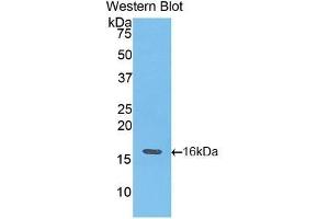 Western Blotting (WB) image for anti-Fast Skeletal Troponin T3a (TNNT3A) (AA 147-269) antibody (ABIN1176067) (TNNT3A antibody  (AA 147-269))