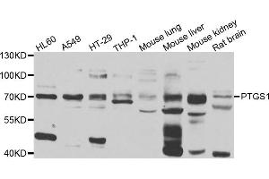 Western blot analysis of extracts of various cell lines, using PTGS1 antibody (ABIN5975503) at 1/1000 dilution. (PTGS1 antibody)