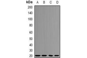 Western blot analysis of Centrin-3 expression in MCF7 (A), Jurkat (B), mouse testis (C), mouse lung (D) whole cell lysates. (CETN3 antibody)