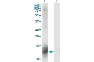 Western Blot analysis of NR3C2 expression in transfected 293T cell line by NR3C2 monoclonal antibody (M01), clone 2B5. (NR3C2 antibody  (AA 1-110))