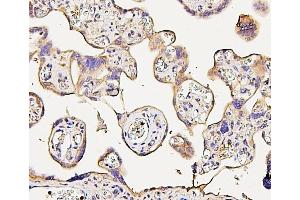 IHC analysis of NMI using anti-NMI antibody (ABIN6719489). (NMI antibody  (AA 2-307))