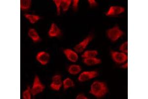 ABIN6266987 staining sw480 by IF/ICC. (KRT16 antibody  (N-Term))