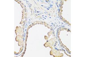 Immunohistochemistry of paraffin-embedded human prostate using B2M antibody. (beta-2 Microglobulin antibody  (AA 21-119))