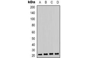 Western blot analysis of HP1 gamma (pS93) expression in Jurkat (A), K562 (B), A431 (C), Raw264. (CBX3 antibody  (pSer93))