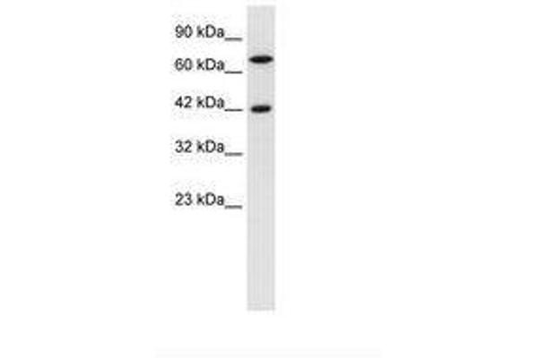 TOX2 antibody  (N-Term)