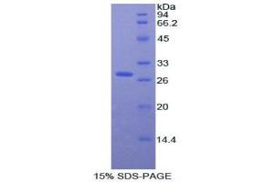 SDS-PAGE analysis of Rat aHSG Protein. (Fetuin A Protein)