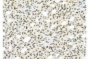 ABIN6263108 and ABIN6266800 at 1/100 staining Rat kidney tissue by IHC-P. (MAP3K6 antibody  (C-Term))