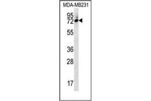 Western blot analysis of SIX5 Antibody  in MDA-MB231 cell line lysates (35ug/lane). (Six5 antibody  (Middle Region))