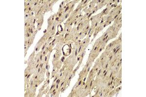 Immunohistochemistry of paraffin-embedded human colon using PSMB8 antibody. (PSMB8 antibody  (AA 163-272))