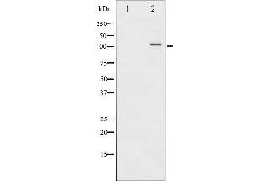 Western Blotting (WB) image for anti-Nuclear Factor of kappa Light Polypeptide Gene Enhancer in B-Cells 2 (NFKB2) (pSer872) antibody (ABIN6255544)