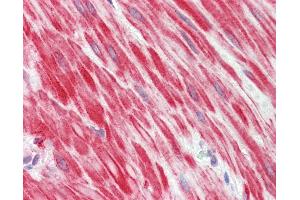 Anti-MYOD / MYOD1 antibody IHC staining of human small intestine, muscularis propria. (MYOD1 antibody  (AA 211-240))