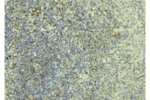ABIN6276638 at 1/100 staining Human lymph tissue by IHC-P. (CD3D antibody  (Internal Region))