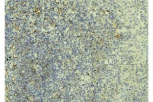 ABIN6276638 at 1/100 staining Human lymph tissue by IHC-P.