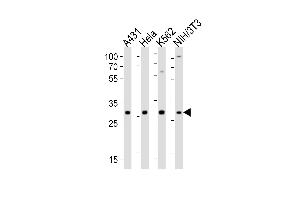 Western blot analysis of lysates from A431, Hela, K562, mouse NIH/3T3 cell line (from left to right), using CDK5 Antibody (C-term) (ABIN6242783 and ABIN6577637). (CDK5 antibody  (C-Term))