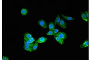 Immunofluorescent analysis of HepG2 cells using ABIN7165903 at dilution of 1:100 and Alexa Fluor 488-congugated AffiniPure Goat Anti-Rabbit IgG(H+L) (Patched 1 antibody  (AA 1180-1411))