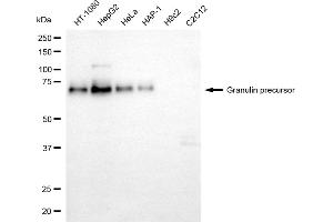 Western blotting analysis using granulin precursor antibody (ABIN7798800).
