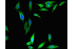 Immunofluorescent analysis of Hela cells using ABIN7149493 at dilution of 1:100 and Alexa Fluor 488-congugated AffiniPure Goat Anti-Rabbit IgG(H+L) (DAZAP1 antibody  (AA 1-300))