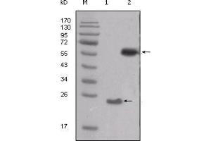 Western blot analysis using SRC mouse mAb against truncated SRC-His recombinant protein (1) and PMA treated THP-1 cell lysate (2). (Src antibody  (AA 10-193))