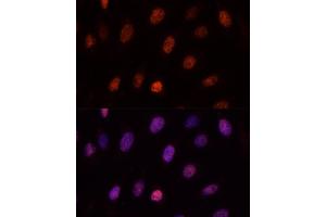 Immunofluorescence analysis of U-2OS cells using PCGF1 antibody (ABIN6129080, ABIN6145307, ABIN6145308 and ABIN6221952) at dilution of 1:100. (PCGF1 antibody  (AA 20-259))