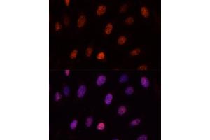 Immunofluorescence analysis of U-2OS cells using PCGF1 antibody (ABIN6129080, ABIN6145307, ABIN6145308 and ABIN6221952) at dilution of 1:100. (PCGF1 antibody  (AA 20-259))