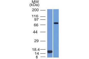 Western Blot of (1) Recombinant MMP2 protein and (2) U87 cell lysate using MMP2 Monoclonal Antibody (MMP2/1501). (MMP2 antibody  (AA 444-575))